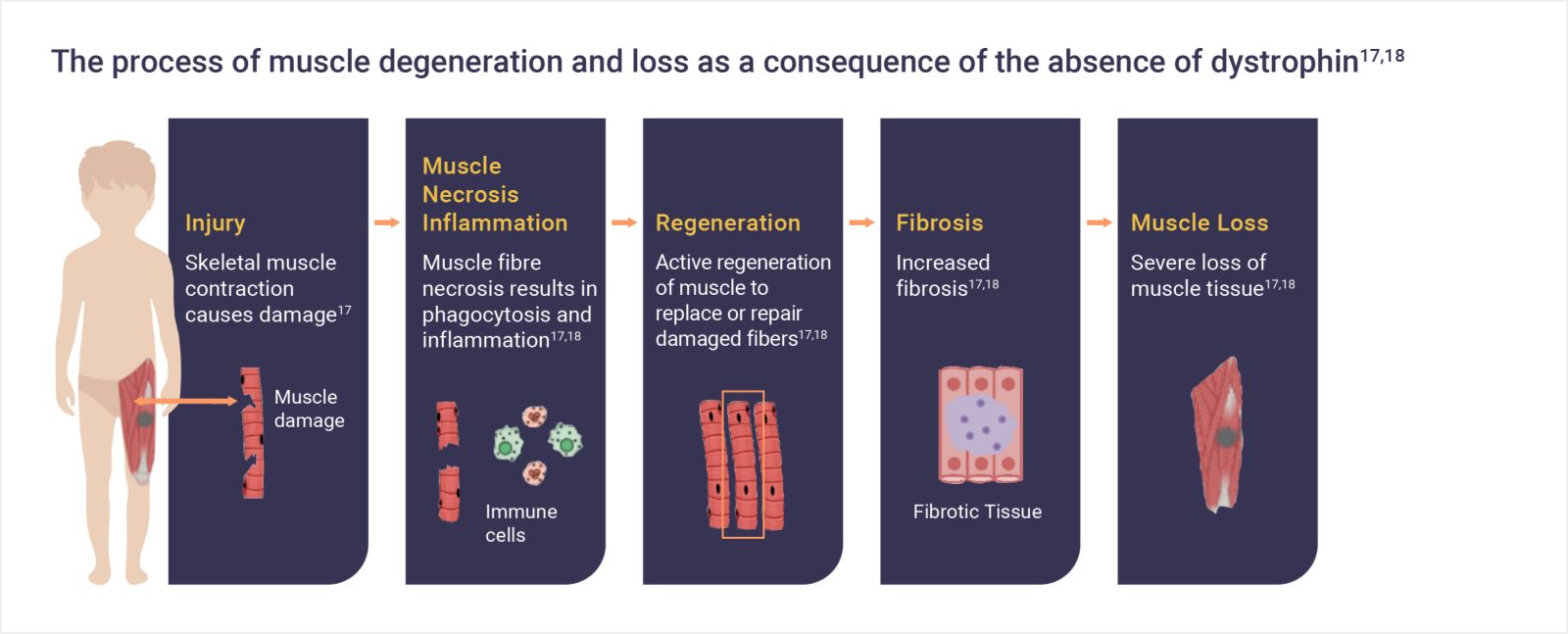 Infographic: The process of muscle degeneration and loss as a consequence of the absence of dystrophin