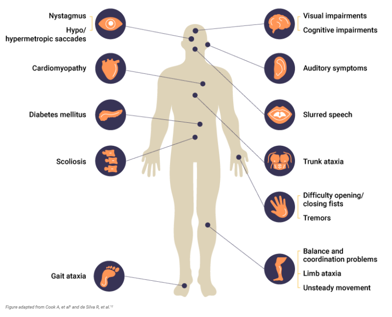 Friedreich’s ataxia disease overview - MEDhub